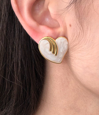 Aretes